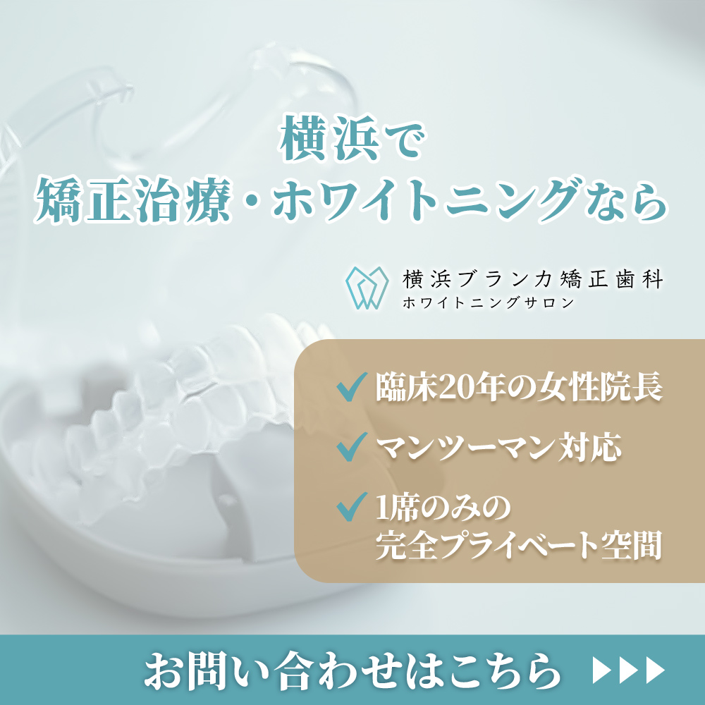 離脱バナー